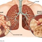 Jenis Penyakit yang Berbahaya di Dunia